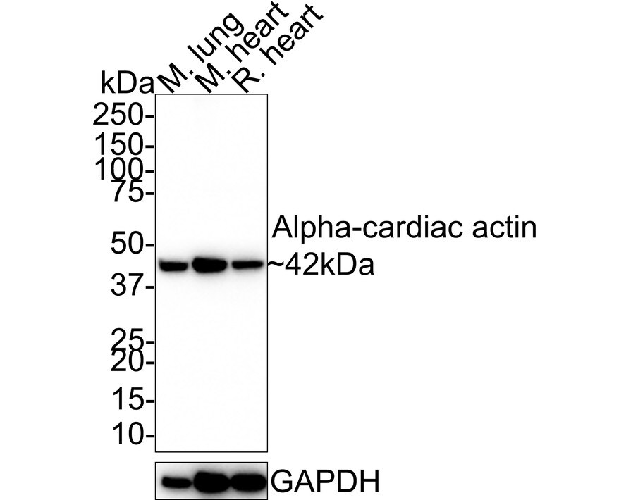 Actin Alpha 1 Cardiac Muscle Antibody (33-32-R) Western Blot: Actin Alpha 1 Cardiac Muscle Antibody (33-32-R) [NBP3-32032]