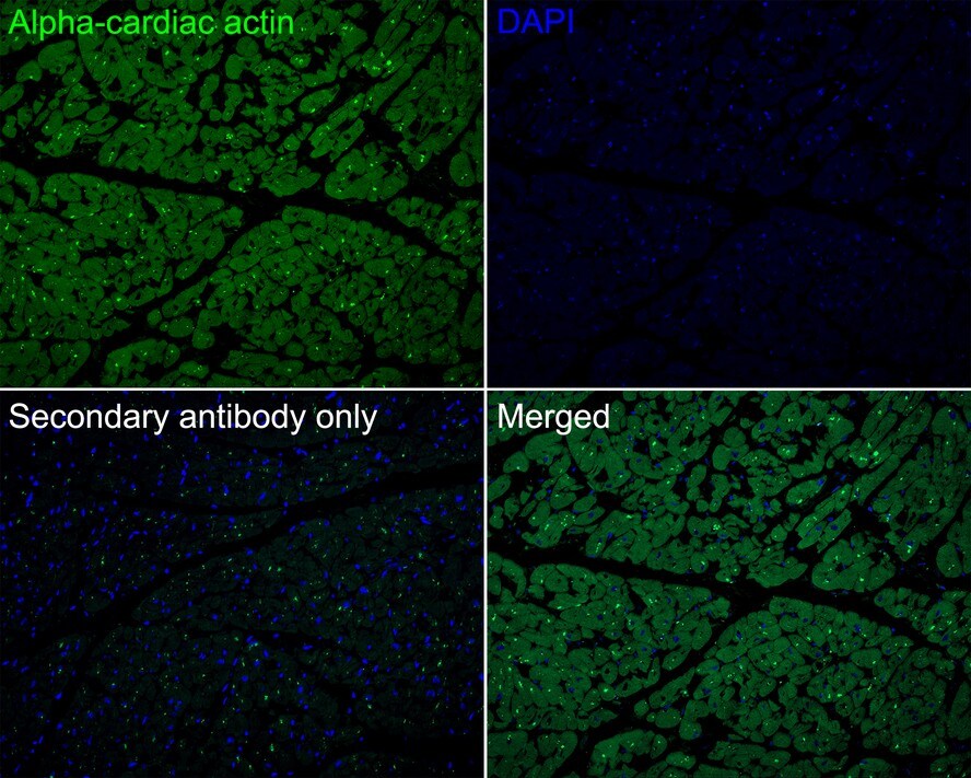 Actin Alpha 1 Cardiac Muscle Antibody (33-32-R)
