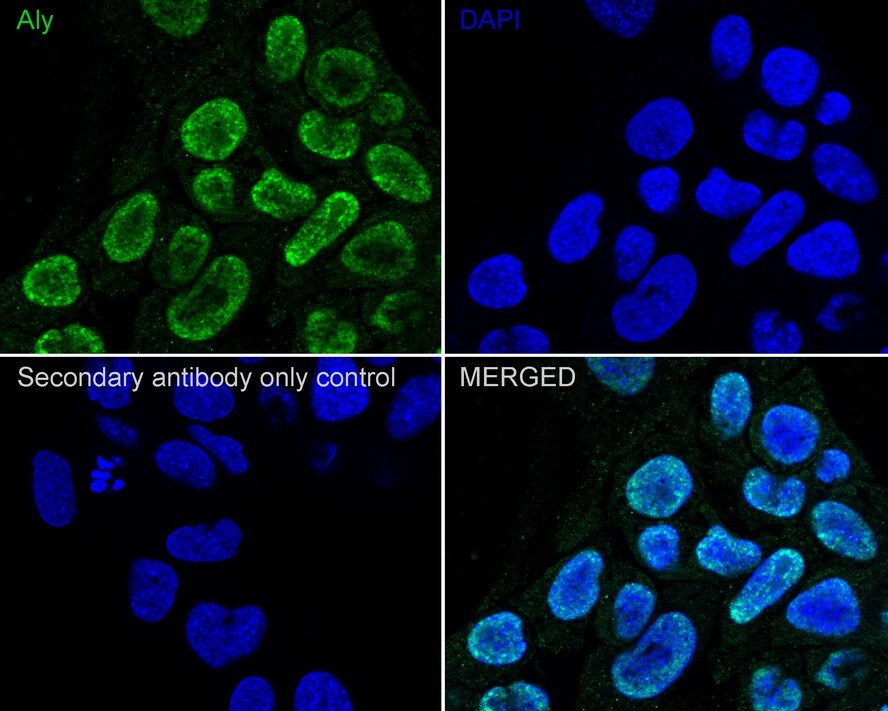 Aly Antibody (JE36-45)
