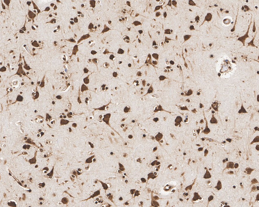 Aly Antibody (JE36-45)