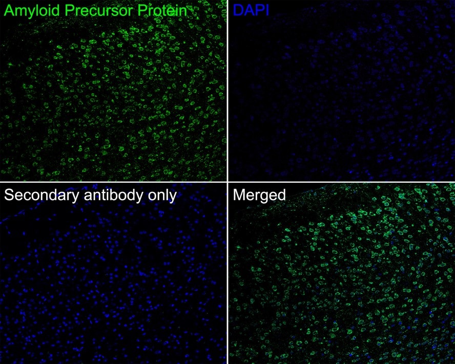APP Antibody (JE30-54)