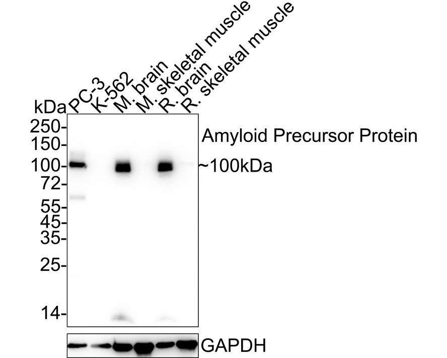 APP Antibody (JE30-54)