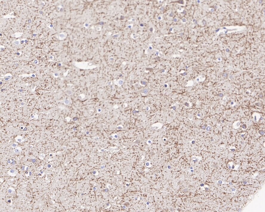 APP Antibody (JE30-54)