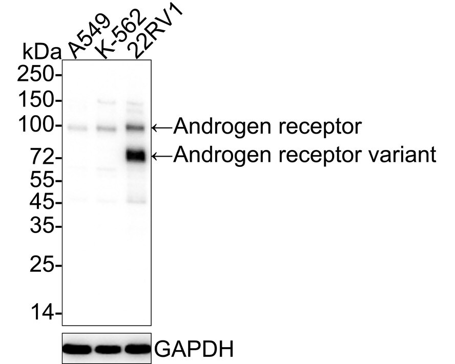 Androgen R/NR3C4 Antibody (PO00-29) Western Blot: Androgen R/NR3C4 Antibody (PO00-29) [NBP3-32035]