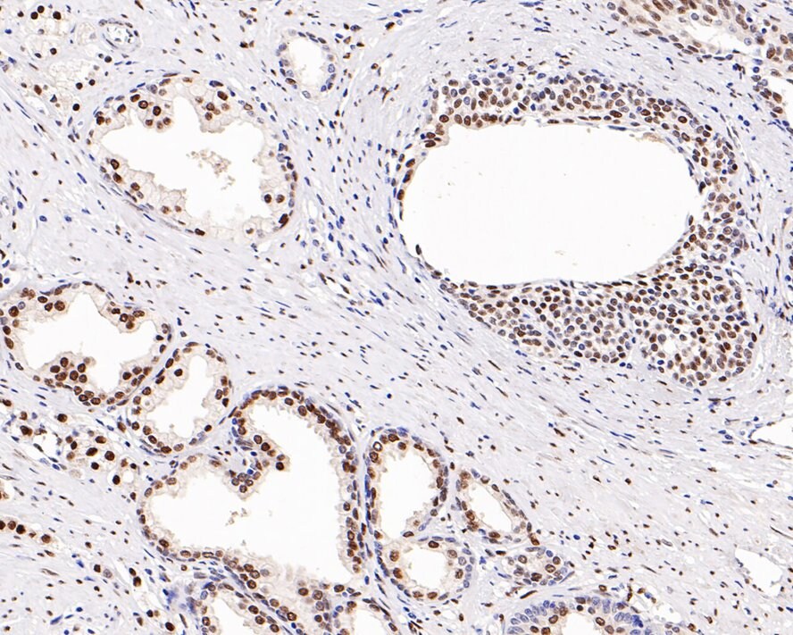 Androgen R/NR3C4 Antibody (PO00-29)