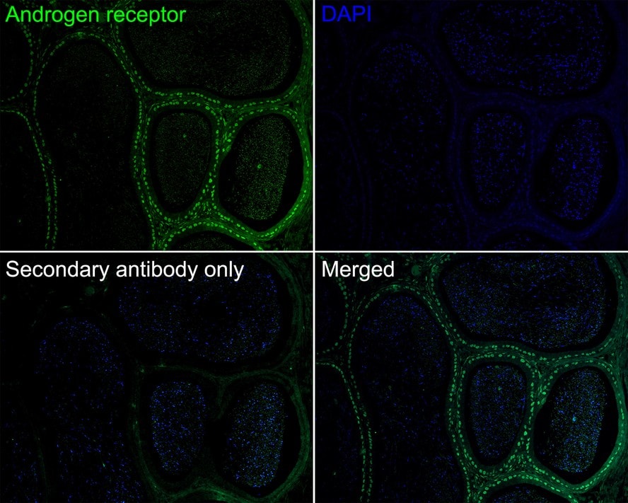 Androgen R/NR3C4 Antibody (PO00-29)