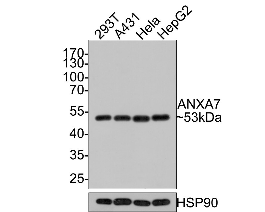 Annexin A7 Antibody (JE65-60) Western Blot: Annexin A7 Antibody (JE65-60) [NBP3-32038]