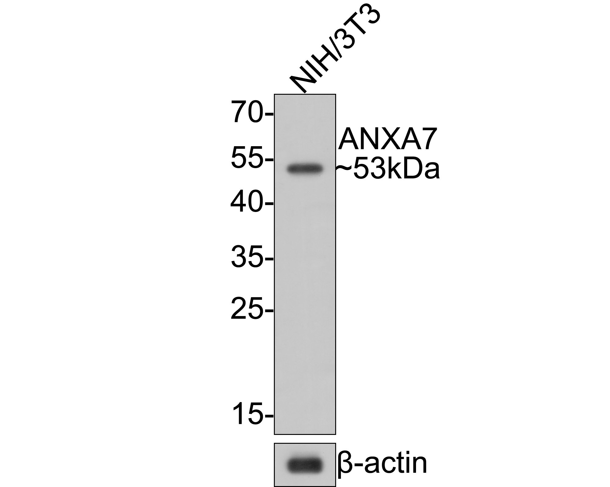 Annexin A7 Antibody (JE65-60) Western Blot: Annexin A7 Antibody (JE65-60) [NBP3-32038]