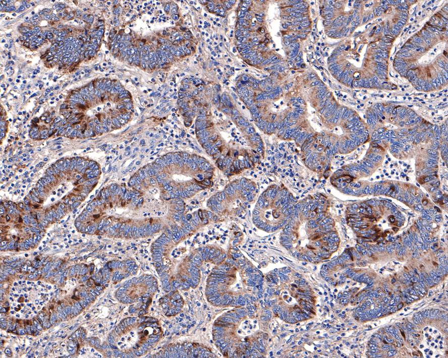 Annexin A7 Antibody (JE65-60)
