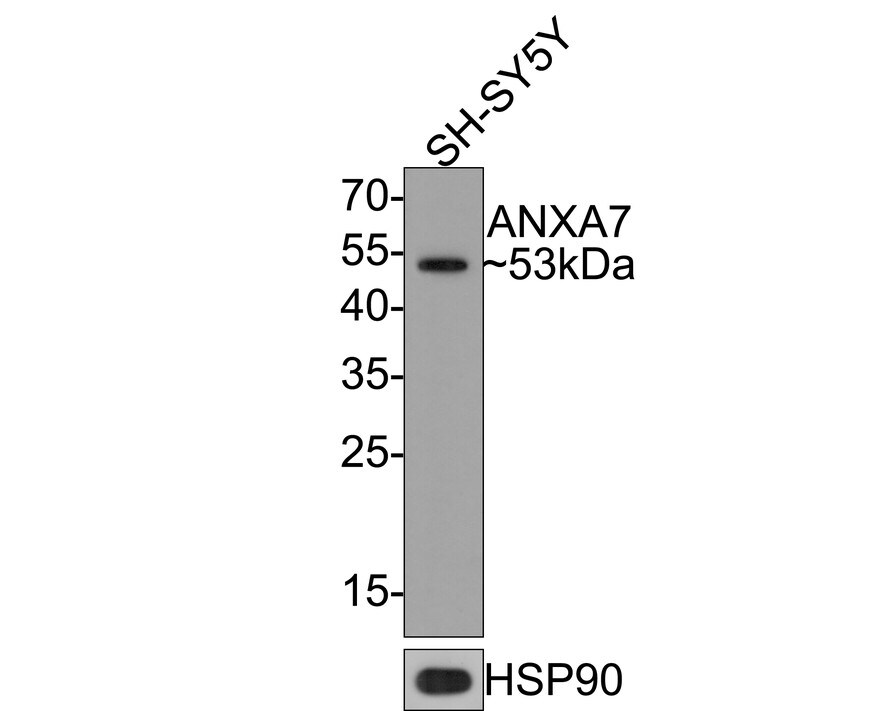 Annexin A7 Antibody (JE65-36) Western Blot: Annexin A7 Antibody (JE65-36) [NBP3-32039]