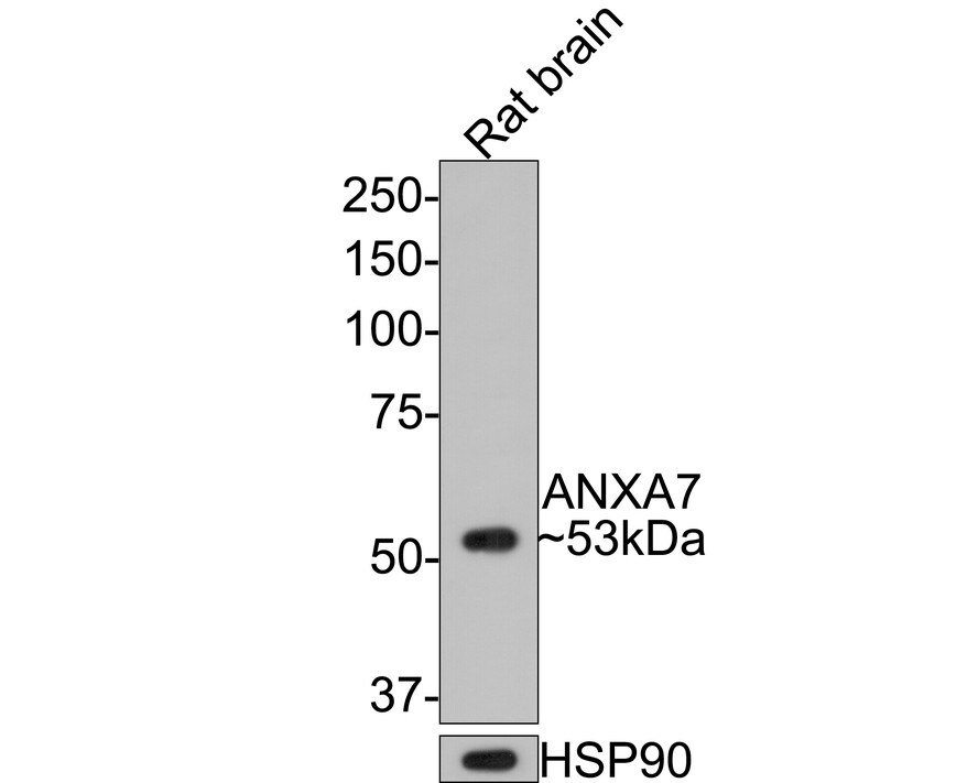 Annexin A7 Antibody (JE65-36) Western Blot: Annexin A7 Antibody (JE65-36) [NBP3-32039]
