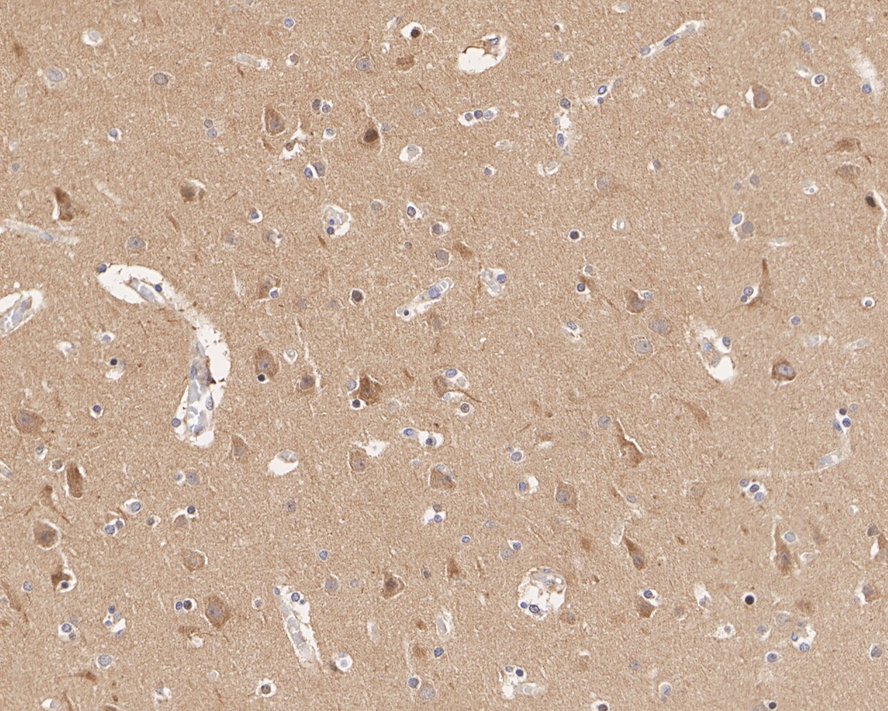 alpha Adaptin Antibody (JE40-38)