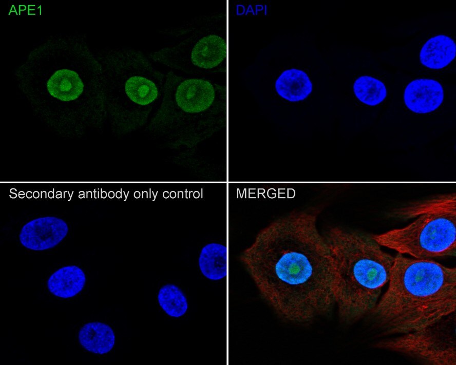 APE Antibody (12H1-R)