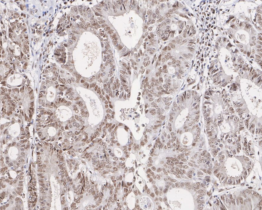 APE Antibody (12H1-R)