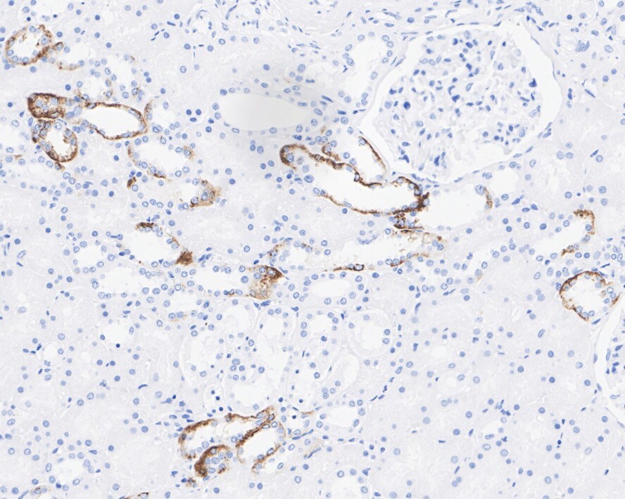 Aquaporin-4 Antibody (JE59-76)