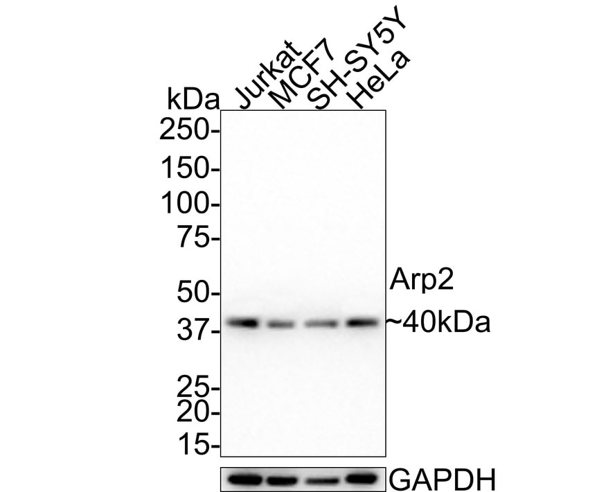 ACTR2 Antibody (JE40-62)