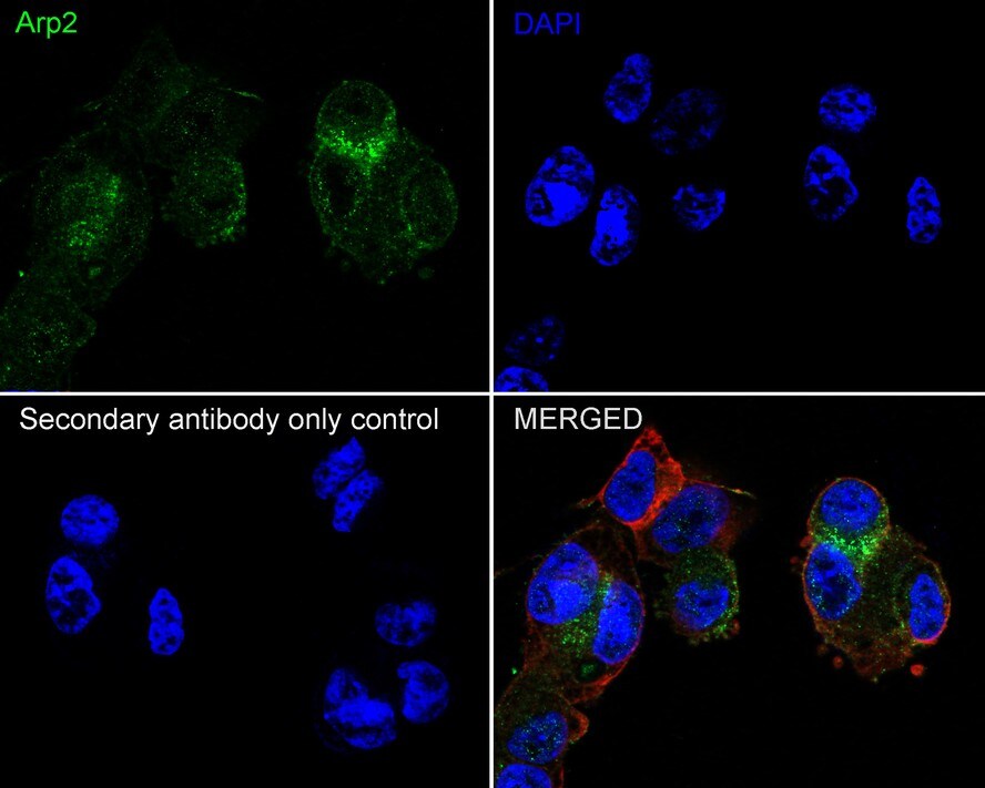ACTR2 Antibody (JE40-62)