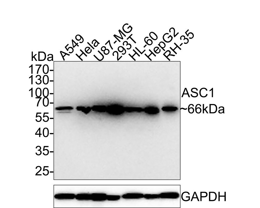ASC1 Antibody (PSH0-26) Western Blot: ASC1 Antibody (PSH0-26) [NBP3-32049]