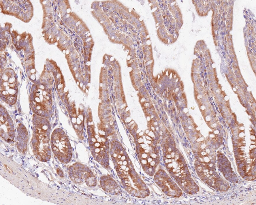 ASC1 Antibody (PSH0-26)