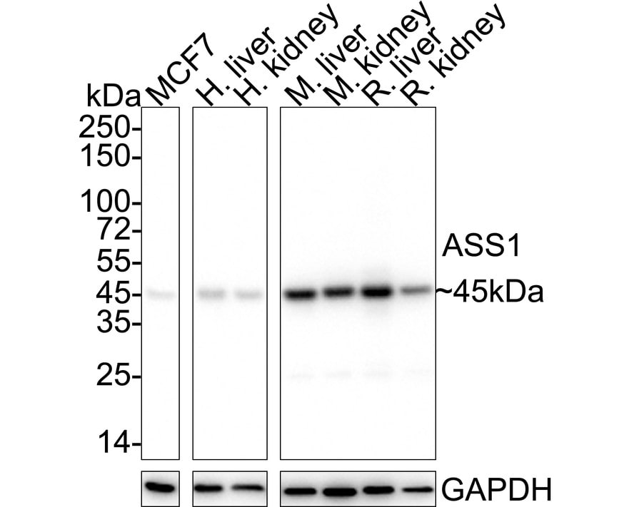 Argininosuccinate Synthase Antibody (11F1-RA) Western Blot: Argininosuccinate Synthase Antibody (11F1-RA) [NBP3-32051]
