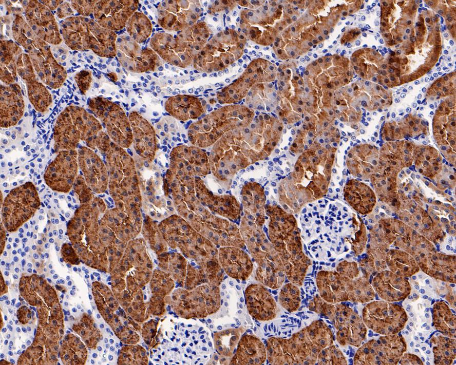 Argininosuccinate Synthase Antibody (11F1-RA)