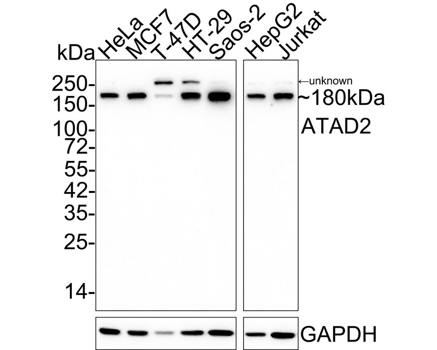 ATAD2 Antibody (JE34-52) Western Blot: ATAD2 Antibody (JE34-52) [NBP3-32052]