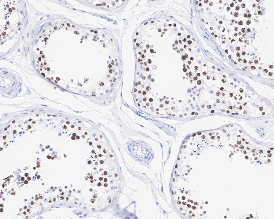 ATAD2 Antibody (JE34-52)