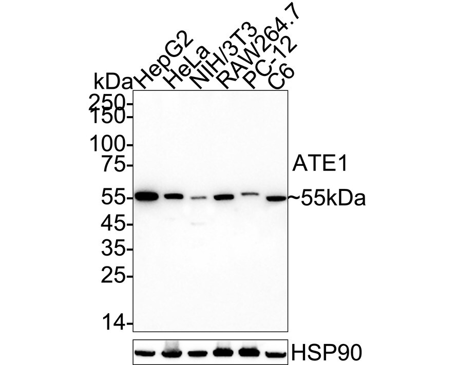 ATE1 Antibody (JE65-47) Western Blot: ATE1 Antibody (JE65-47) [NBP3-32053]