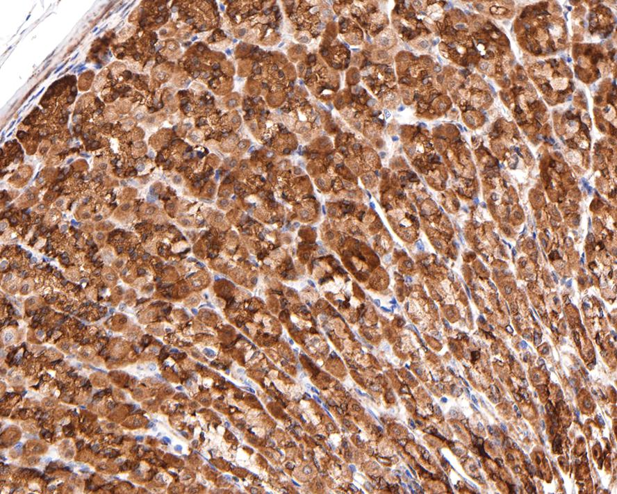 ATE1 Antibody (JE65-47)