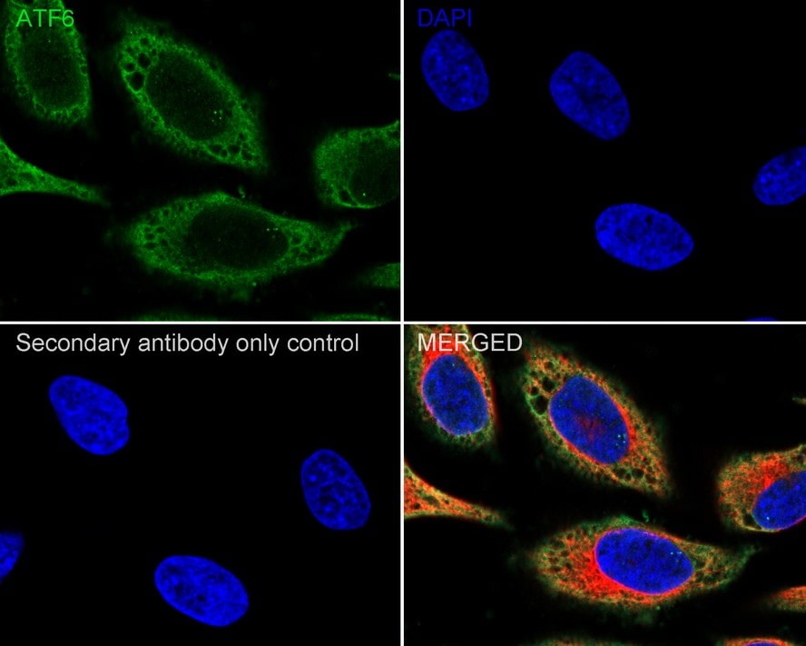ATF6 Antibody (8D3-R)