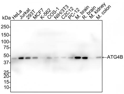 ATG4B Antibody (PSH02-53) Western Blot: ATG4B Antibody (PSH02-53) [NBP3-32058]