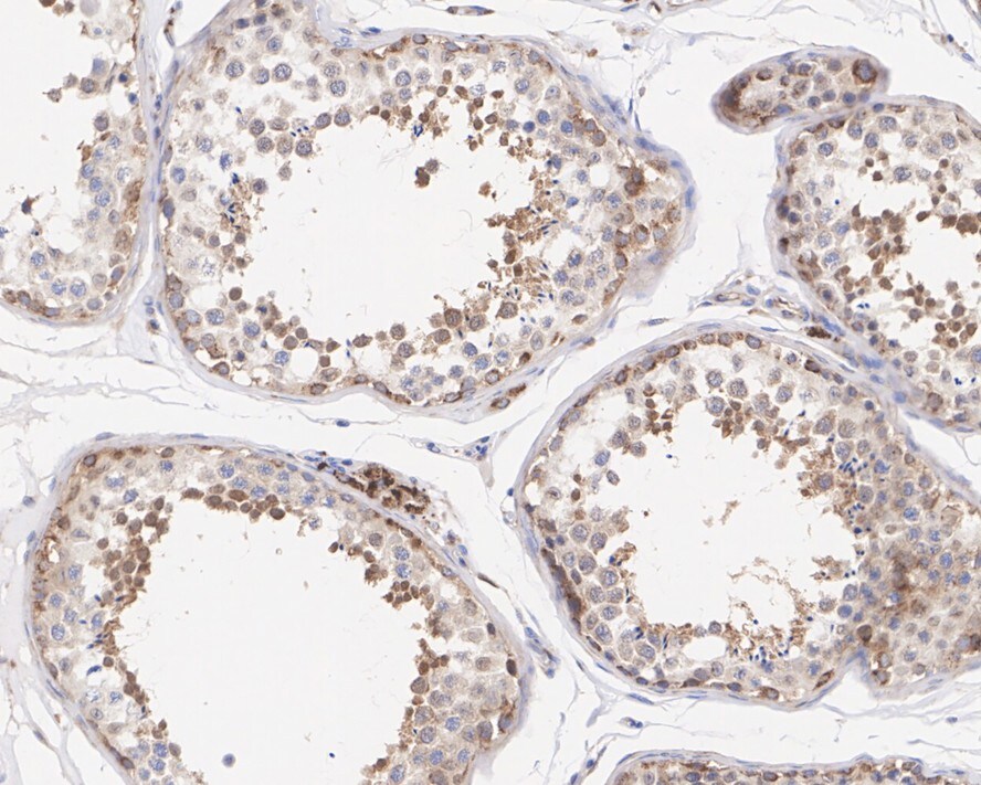ATG4C Antibody (JE59-99)