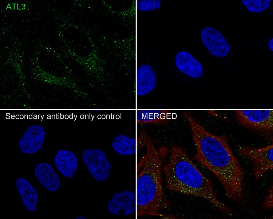 Atlastin-3 Antibody (PSH02-47)