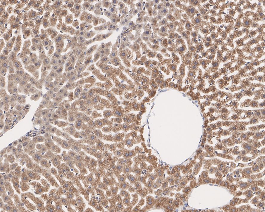 Atlastin-3 Antibody (PSH02-47)