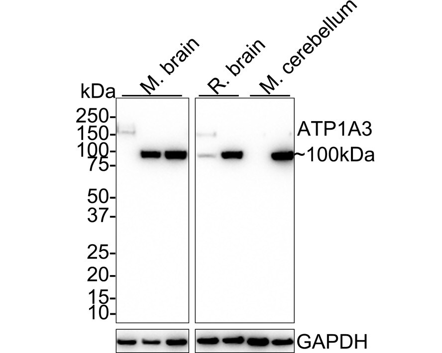 Sodium Potassium ATPase Alpha 3 Antibody (JE35-24) Western Blot: Sodium Potassium ATPase Alpha 3 Antibody (JE35-24) [NBP3-32062]