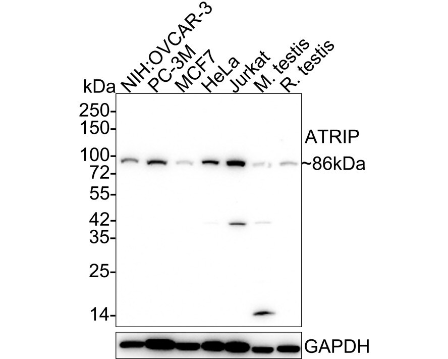 ATRIP Antibody (JE54-71) Western Blot: ATRIP Antibody (JE54-71) [NBP3-32063]