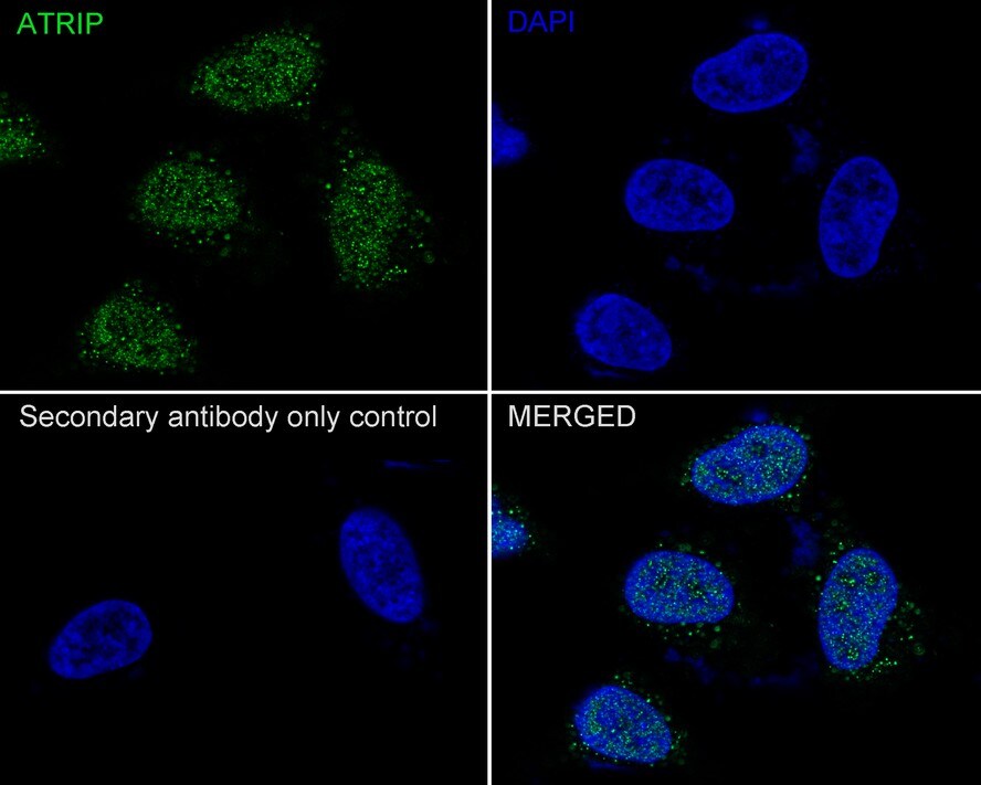 ATRIP Antibody (JE54-71)