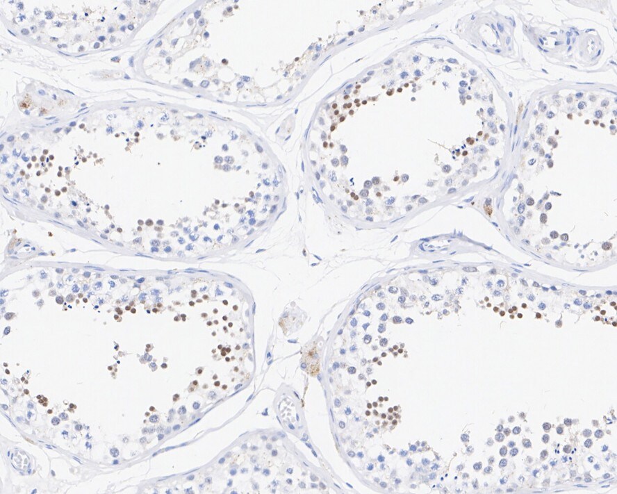 ATRIP Antibody (JE54-71)