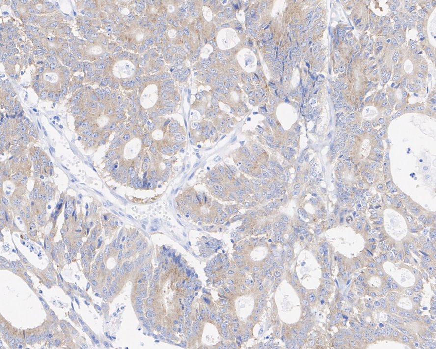 Axin-1 Antibody (PSH03-00)