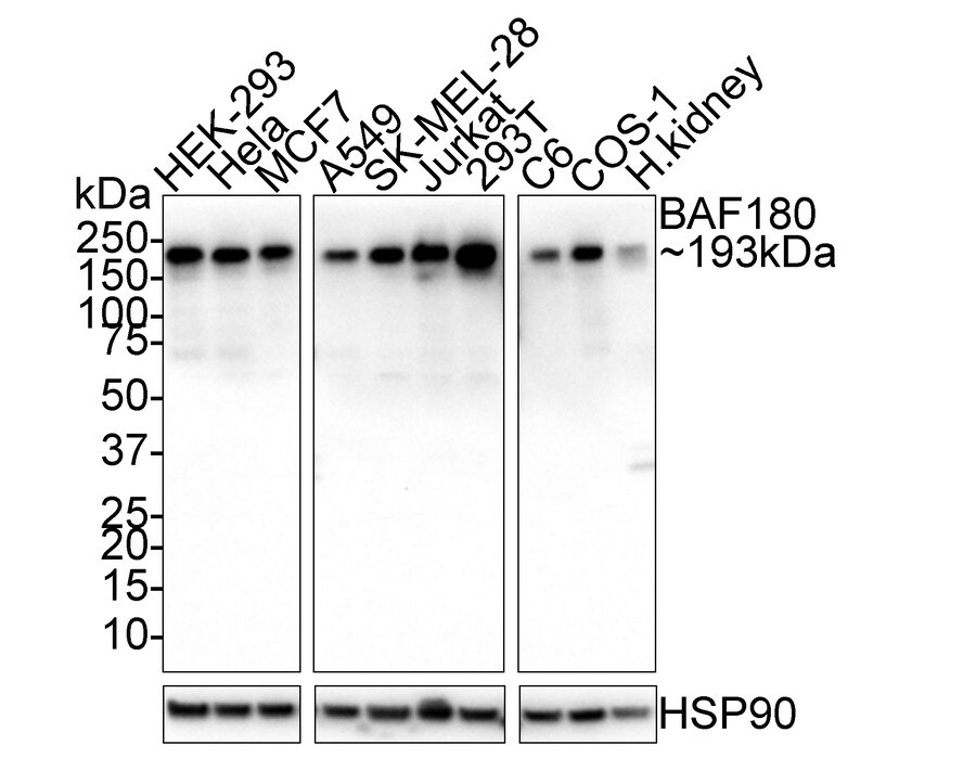 BAF180/PB1 Antibody (PSH02-34) Western Blot: BAF180/PB1 Antibody (PSH02-34) [NBP3-32067]