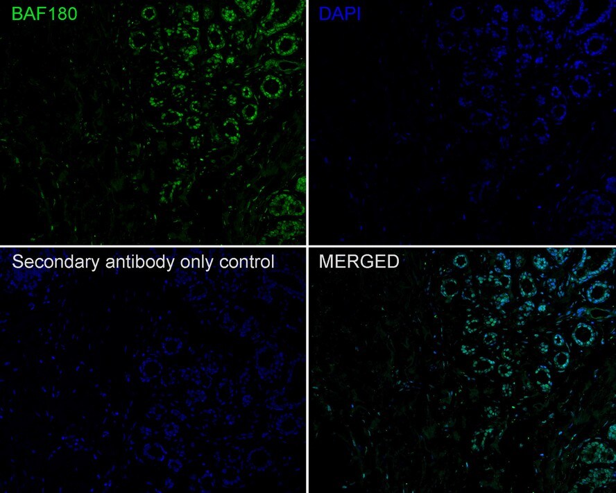 BAF180/PB1 Antibody (PSH02-34)
