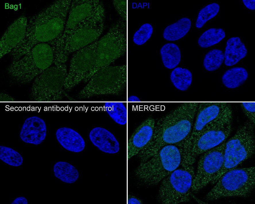 Bag-1 Antibody (JE63-22)