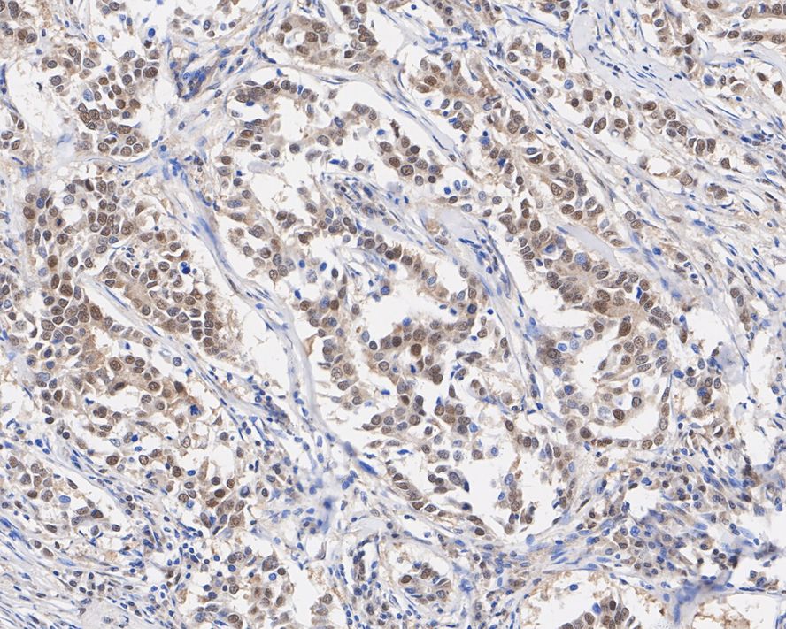 Bag-1 Antibody (JE63-22)