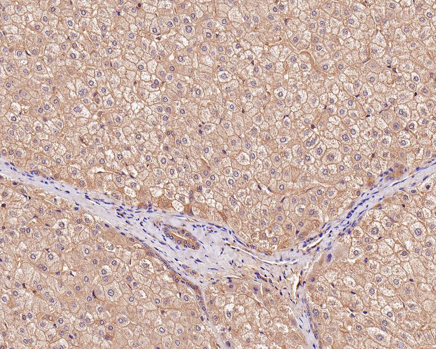Bax Antibody (PSH0-20)