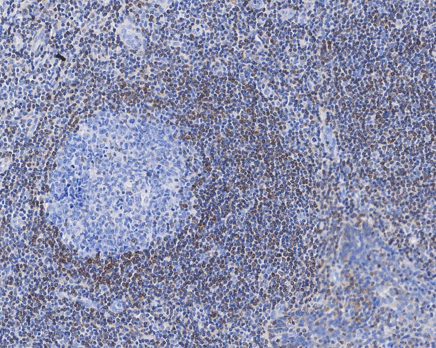 Bcl-2 Antibody (9F3-R)