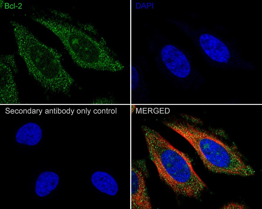 Bcl-2 Antibody (PD01-41)