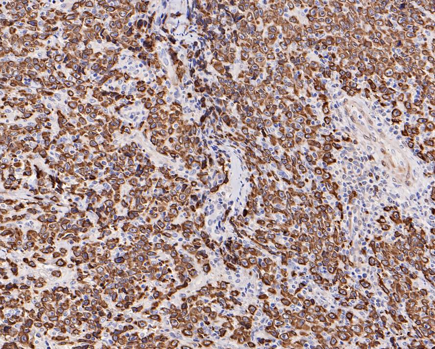 Bcl-2 Antibody (PD01-41)