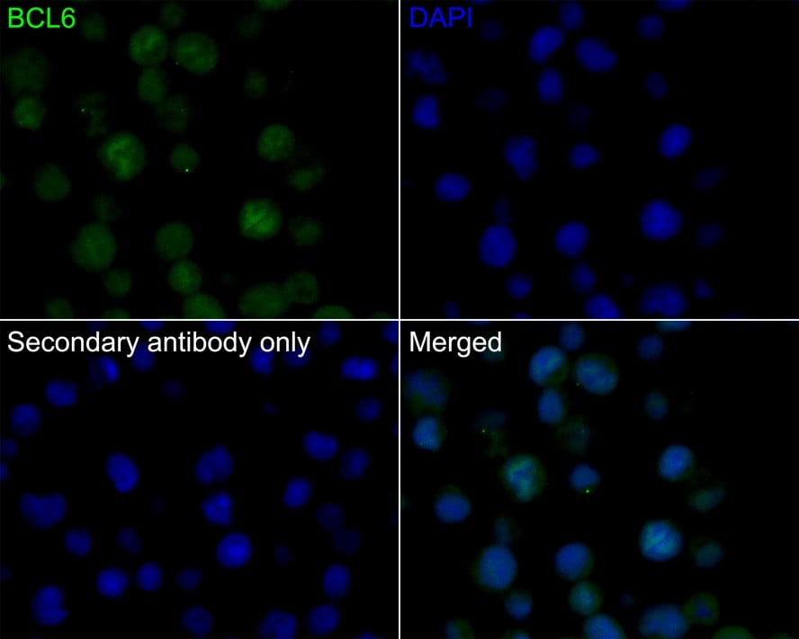Bcl-6 Antibody (A6C7-R)