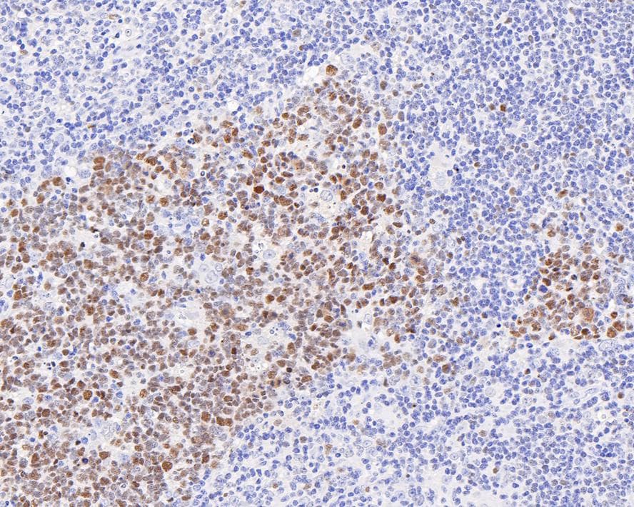 Bcl-6 Antibody (A6C7-R)