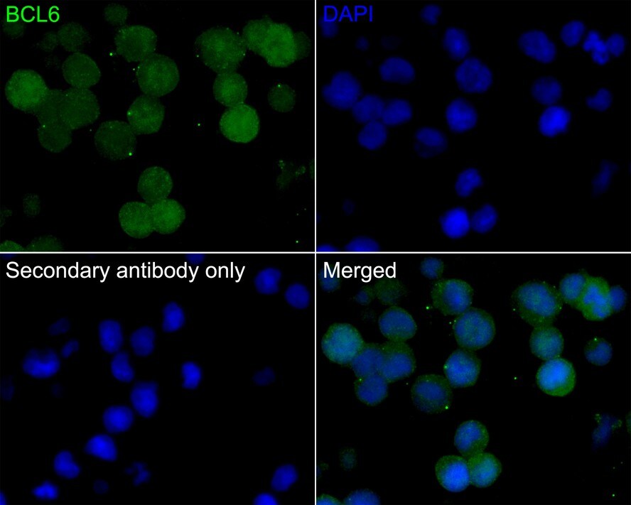 Bcl-6 Antibody (A6C8-R)